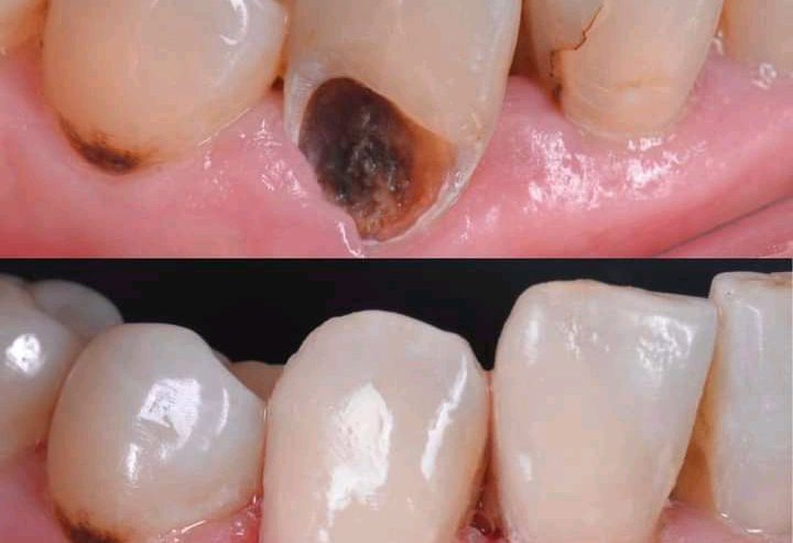 Dental care kampala