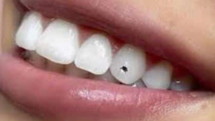 Dental gems kampala